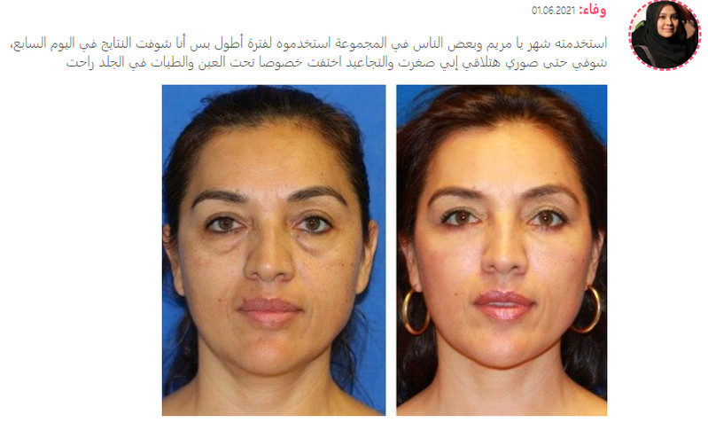 Monina Cream اكريم مونين كريم مونيلا كير